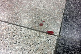 改札付近についた血痕