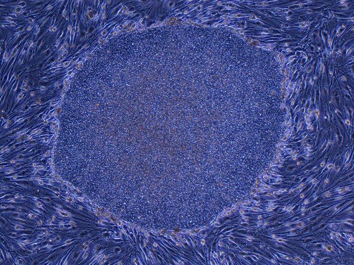 繊維芽細胞から樹立したヒトiPS細胞のコロニー（提供・京都大学iPS細胞研究所）