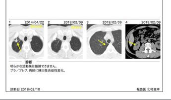 名ばかり「CT・MRI大国」ニッポンを救う「遠隔画像診断」「AI」融合の可能性