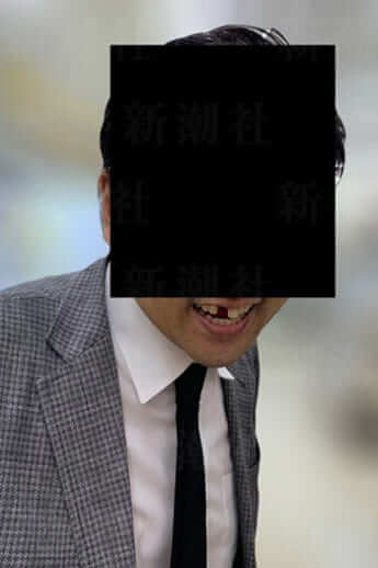 前歯が折れた社員