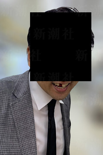 前歯が折れた社員
