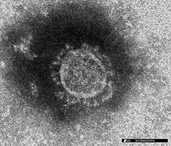 新型コロナウイルスの電子顕微鏡写真（国立感染症研究所HPより）