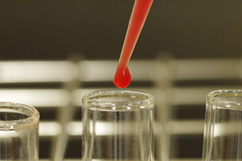 抗体検査イメージ