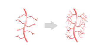 新しい血管が生成される様子（イメージ）