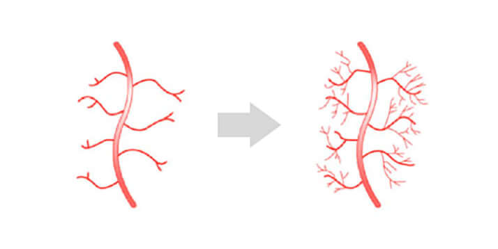 新しい血管が生成される様子（イメージ）