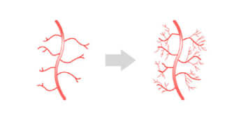 新しい血管が生成される様子（イメージ）