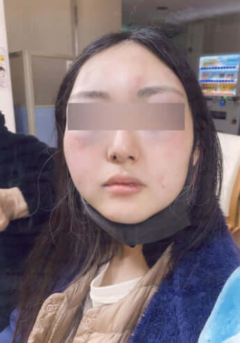 DVを受けた妻