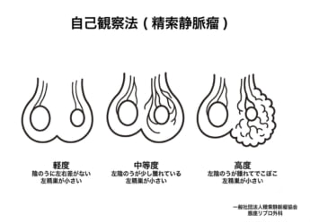 男性不妊4