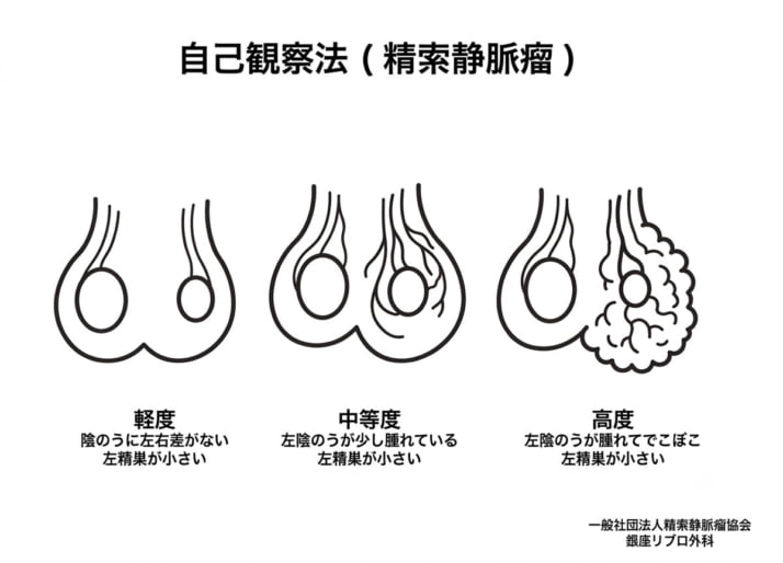 男性不妊1